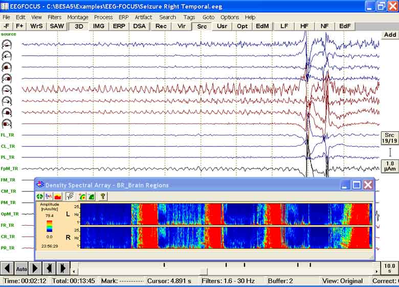 EEGFocus 3.x (c) MEGIS Software GmbH *Dongle Emulator (Dongle Crack) for Aladdin Hardlock*