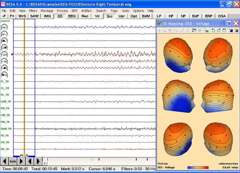 BESA (Brain Electrical Source Analysis) 4.x/5.x, 5.1.8 (c) MEGIS Software GmbH *Dongle Emulator (Dongle Crack) for Aladdin Hardlock*